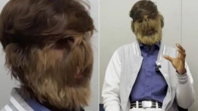 सबसे अधिक बालों वाले चेहरे के साथ मध्य प्रदेश के लड़के ने बनाया गिनीज वर्ल्ड रिकॉर्ड, जानें कैसे फेस पर आए इतने हेयर?